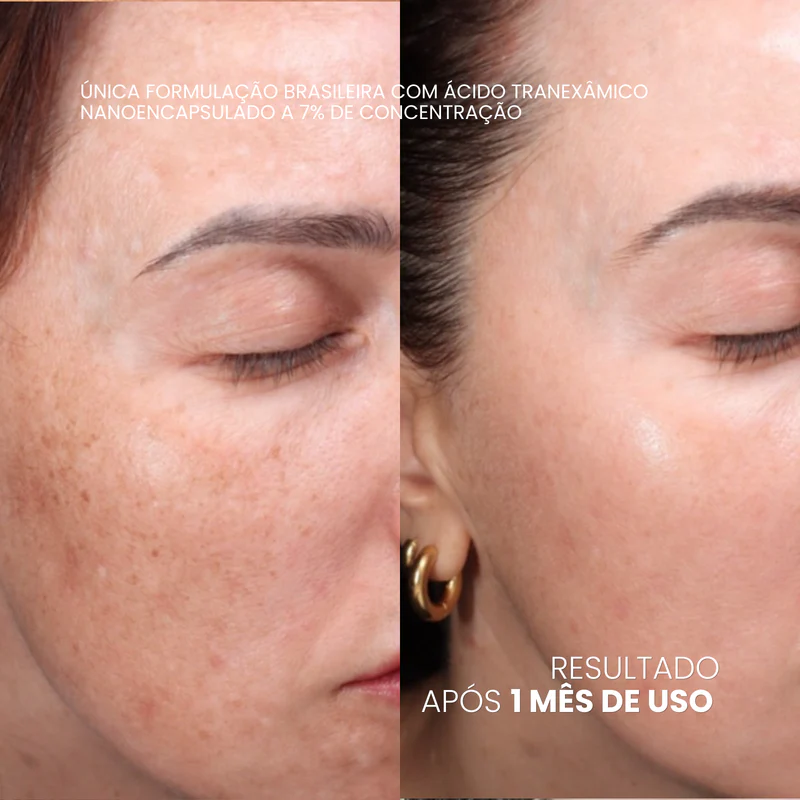 Antes e depois — Fátima