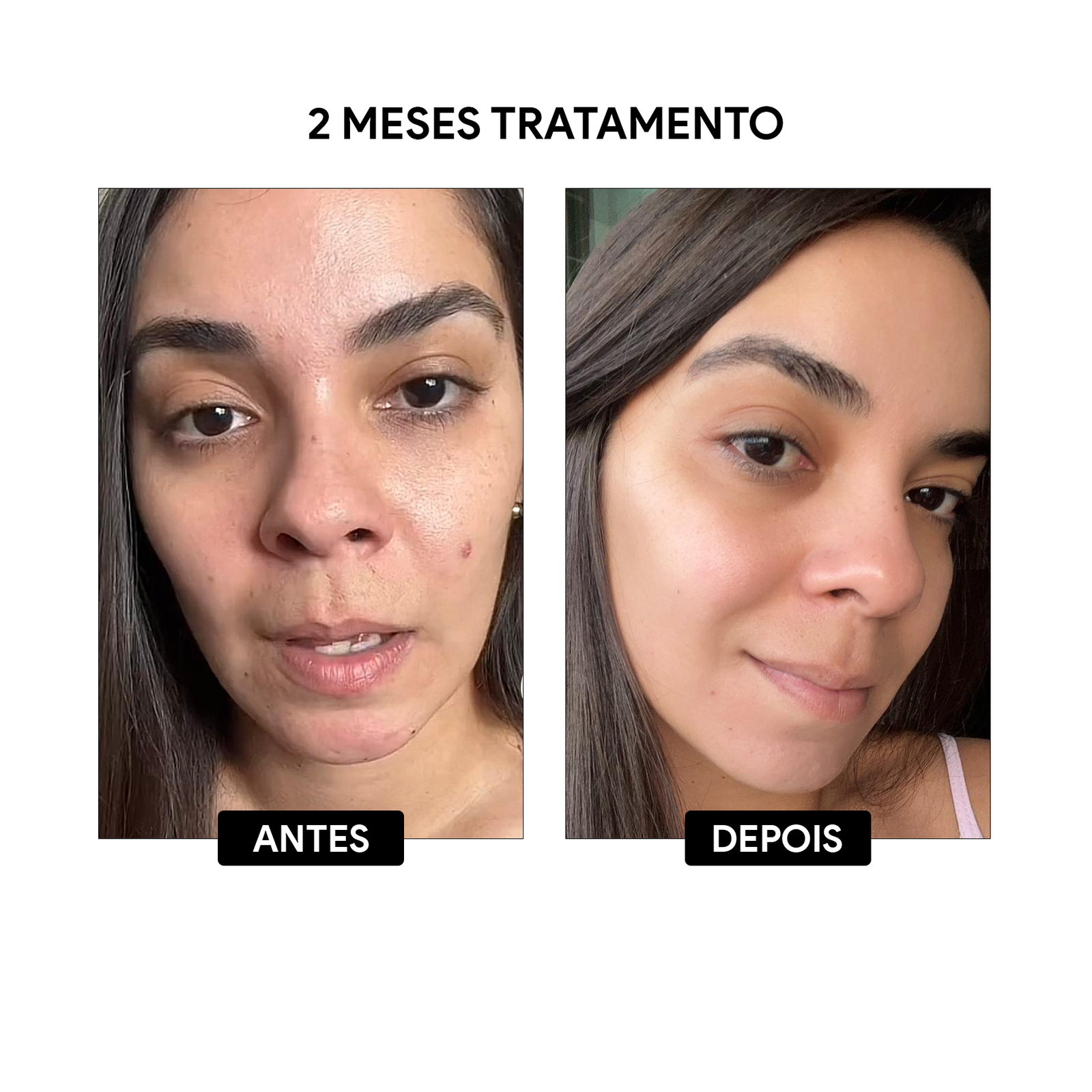 antes e depois03